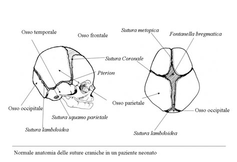 cranosteniosi2